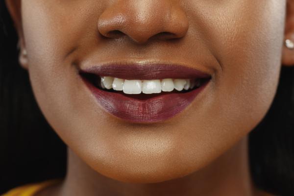 Blanchiment de dents
