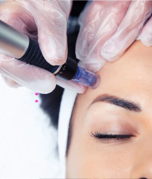 Soins Microneedling